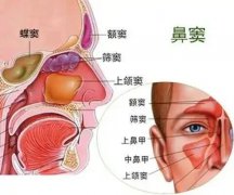【全國(guó)愛(ài)鼻日】孩子出現(xiàn)這些癥狀，警惕鼻竇炎！ 